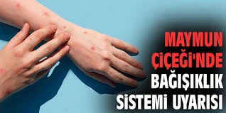 Maymun Çiçeğinde Bağışıklık Sistemi Uyarısı